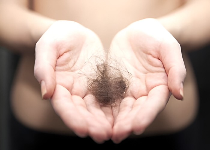A queda de cabelo é um resultado de alguma deficiência orgânica. O Instituto Shalon - dirigido pela Dra. Elizete Kaffer - possui terapias especiais para cada caso.